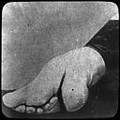 Les pieds chinois
